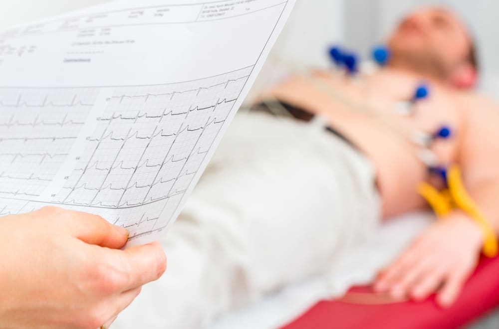heart arrhythmia symptoms